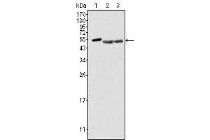 Western Blot showing PTK6 antibody used against Hela (1), A549 (2) and MCF-7 (3) cell lysate. (PTK6 Antikörper)
