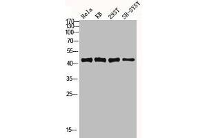 Western blot analysis of Hela KB 293T SH-SY5Y lysis using MKP-1/2 antibody.