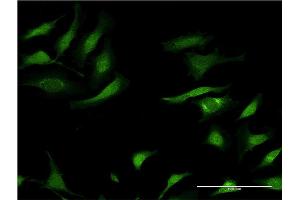 Immunofluorescence of monoclonal antibody to SERPINA3 on HeLa cell. (SERPINA3 Antikörper  (AA 25-423))