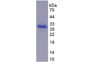 SDS-PAGE of Protein Standard from the Kit  (Highly purified E. (ADAM17 ELISA Kit)