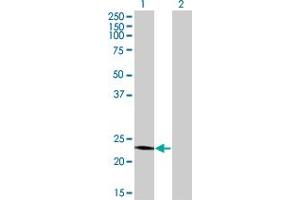 Western Blot analysis of RCV1 expression in transfected 293T cell line by RCV1 monoclonal antibody (M09), clone 4E2. (Recoverin Antikörper  (AA 101-199))