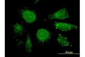 Immunofluorescence of purified MaxPab antibody to GDF3 on HeLa cell. (GDF3 Antikörper  (AA 1-364))
