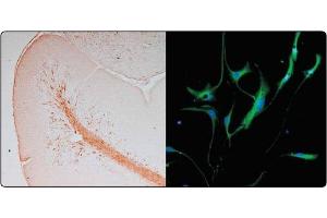 In the Left panel (a tissue section through an e18 Mouse cerebellum), Vimentin (brown staining) can be seen in immature astrocytes of the white matter, as well as in vascular endothelial cells.