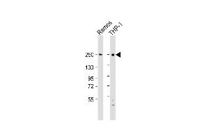 All lanes : Anti-DOCK8 Antibody (C-Term) at 1:2000 dilution Lane 1: Ramos whole cell lysate Lane 2: THP-1 whole cell lysate Lysates/proteins at 20 μg per lane. (DOCK8 Antikörper  (AA 2056-2090))