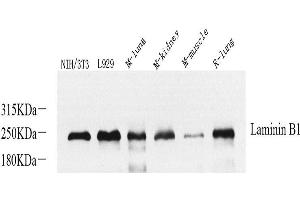Western Blot analysis of various samples using Laminin beta1 Polyclonal Antibody at dilution of 1:800. (Laminin beta 1 Antikörper)