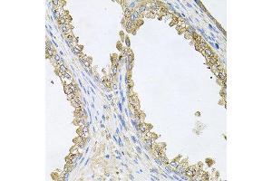 Immunohistochemistry of paraffin-embedded human prostate using HSP90AA1 antibody at dilution of 1:100 (x40 lens). (HSP90AA1 Antikörper)