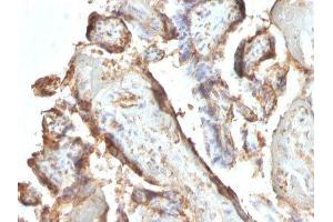 anti-hCG Intact antibody