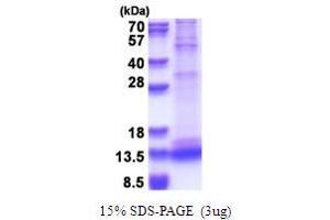 SDS-PAGE (SDS) image for Caspase 3 (CASP3) (AA 176-277) protein (ABIN7280651) (Caspase 3 Protein (CASP3) (AA 176-277))
