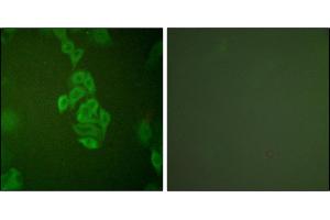 Immunofluorescence analysis of A549 cells, using NSE antibody. (ENO2/NSE Antikörper)