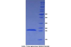 SDS-PAGE analysis of Cow ADAMTS2 Protein. (Adamts2 Protein)