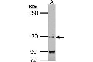 Western Blotting (WB) image for anti-Sin3A-Associated Protein, 130kDa (SAP130) (N-Term) antibody (ABIN1494118)