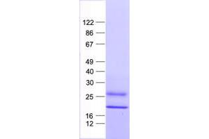 Validation with Western Blot (IFNA6 Protein (His tag))