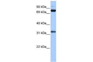Western Blotting (WB) image for anti-TAF6 RNA Polymerase II, TATA Box Binding Protein (TBP)-Associated Factor, 80kDa (TAF6) (C-Term) antibody (ABIN2780702)