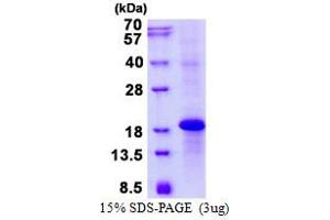 KLRC3 Protein (His tag)