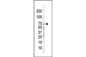 Western Blotting (WB) image for anti-Adrenergic, Beta, Receptor Kinase 1 (ADRBK1) (AA 633-660), (C-Term) antibody (ABIN1882061)