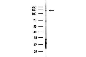 anti-SIK Family Kinase 3 (SIK3) (Internal Region) antibody