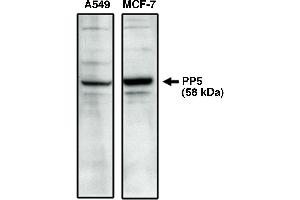 Western blot analysis using PP5 specific antibody on A549 and MCF-7 cell lysates. (PP5.2 Antikörper  (C-Term))