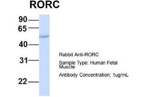Host:  Rabbit  Target Name:  RORC  Sample Type:  Human Fetal Muscle  Antibody Dilution:  1. (RORC Antikörper  (Middle Region))