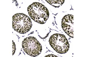 IHC analysis of SAE2/UBA2 using anti-SAE2/UBA2 antibody . (UBA2 Antikörper  (AA 449-564))