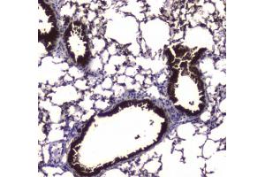 IHC testing of FFPE mouse lung tissue with Carboxylesterase 1 antibody at 1ug/ml.