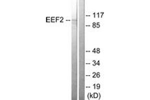 Western blot analysis of extracts from NIH-3T3 cells, treated with serum 10% 30', using eEF2 (Ab-56) Antibody. (EEF2 Antikörper  (AA 31-80))