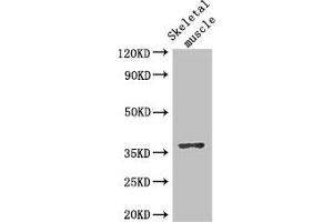 Western Blot Positive WB detected in: Mouse skeletal muscle tissue All lanes: DNAJB6 antibody at 2. (DNAJB6 Antikörper  (AA 208-326))