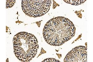 ABIN7096269 and ABIN7100331 at 1/100 staining mouse testis tissue by IHC-P. (SHCBP1L Antikörper)