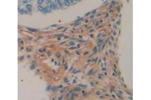 Used in DAB staining on fromalin fixed paraffin- embedded skeletal muscle tissue (Myopalladin Antikörper  (AA 945-1320))