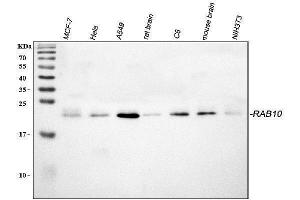 anti-RAB10, Member RAS Oncogene Family (RAB10) (AA 153-185), (C-Term) antibody