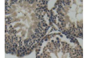 IHC-P analysis of Mouse Testis Tissue, with DAB staining. (SEMA4D/CD100 Antikörper  (AA 502-636))
