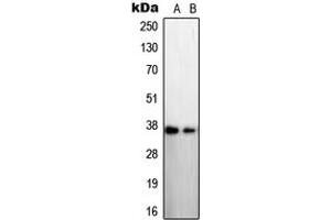 Western blot analysis of STEAP1 expression in LNCaP (A), A431 (B) whole cell lysates. (STEAP1 Antikörper  (N-Term))