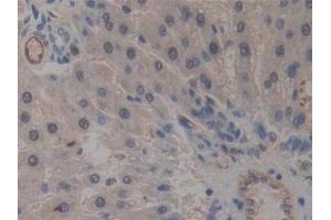Detection of ICAM2 in Rat Liver Tissue using Polyclonal Antibody to Intercellular Adhesion Molecule 2 (ICAM2) (ICAM2 Antikörper  (AA 29-247))