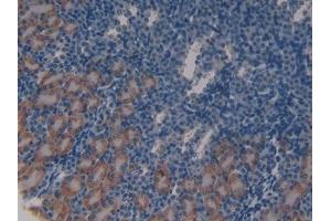 DAB staining on IHC-P; Samples: Mouse Kidney Tissue (ATM Antikörper  (AA 486-742))