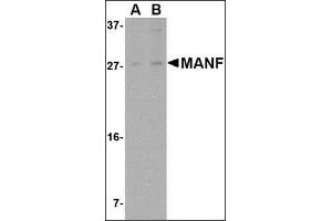 Western blot analysis of MANF in rat brain tissue lysate with this product at (A) 1 and (B) 2 μg/ml. (MANF Antikörper  (N-Term))