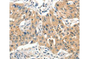 Immunohistochemistry (IHC) image for anti-Solute Carrier Family 11 (Proton-Coupled Divalent Metal Ion Transporters), Member 2 (SLC11A2) antibody (ABIN2432955)