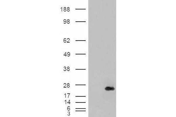 CSRP2 Antikörper  (Internal Region)