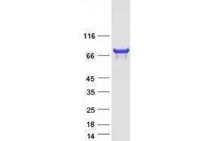 Validation with Western Blot (CENPB Protein (Myc-DYKDDDDK Tag))