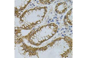 Immunohistochemistry of paraffin-embedded human stomach using SIGMAR1 antibody. (SIGMAR1 Antikörper)