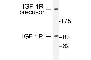 Image no. 1 for anti-Insulin-Like Growth Factor 1 Receptor (IGF1R) antibody (ABIN265476) (IGF1R Antikörper)
