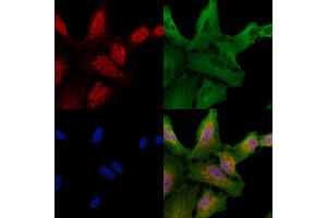 ABIN6257697 and ABIN6274266 staining  cells by IF/ICC. (CLK1 Antikörper  (N-Term))