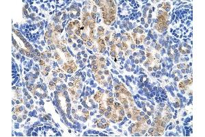 ALDH3A2 antibody was used for immunohistochemistry at a concentration of 4-8 ug/ml to stain Epithelial cells of renal tubule (arrows) in Human Kidney. (ALDH3A2 Antikörper  (C-Term))