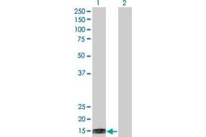 Western Blot analysis of TFF1 expression in transfected 293T cell line by TFF1 monoclonal antibody (M04), clone M2.