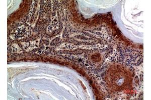 Immunohistochemistry (IHC) analysis of paraffin-embedded Human Skin, antibody was diluted at 1:100. (CCL27 Antikörper)