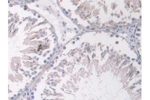 Immunohistochemistry (IHC) image for anti-Angiopoietin 1 (ANGPT1) (AA 304-450) antibody (ABIN7430330)