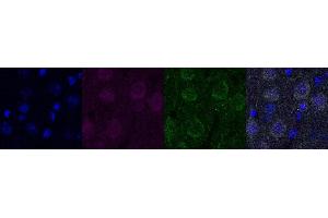 Immunohistochemistry (IHC) image for anti-Ubiquitin Carboxyl-terminal Esterase L1 (Ubiquitin Thiolesterase) (UCHL1) antibody (ABIN7456137) (UCHL1 Antikörper)