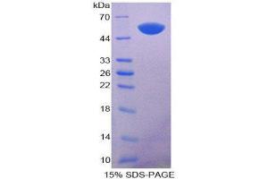 SDS-PAGE (SDS) image for Keratin 14 (KRT14) (AA 1-484) protein (His tag) (ABIN2125545)