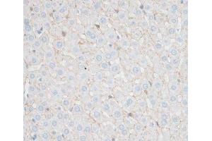 Immunohistochemistry of paraffin-embedded Rat liver using N-Cadherin Polyclonal Antibody at dilution of 1:100 (40x lens). (N-Cadherin Antikörper)