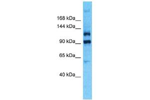 Western Blotting (WB) image for anti-Pleckstrin Homology Domain Containing, Family G (With RhoGef Domain) Member 4B (PLEKHG4B) (C-Term) antibody (ABIN2791858) (PLEKHG4B Antikörper  (C-Term))