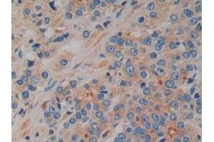 Immunohistochemistry (IHC) image for anti-Prokineticin 2 (PROK2) (AA 30-128) antibody (ABIN7431077)