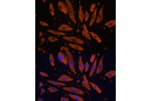 Immunofluorescence analysis of H9C2 cells using CD172a/SIRPα Rabbit pAb (ABIN6130058, ABIN6147780, ABIN6147781 and ABIN6224854) at dilution of 1:100 (40x lens). (SIRPA Antikörper  (AA 395-504))
